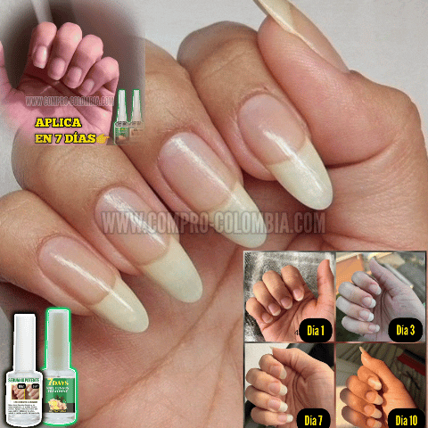 10VECES🙆♀️(COMPRA 1 & LLEVA 2)🎁Uñas +Potente+Crecimiento |