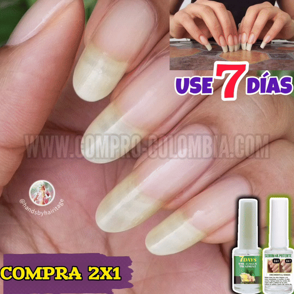 5000% (COMPRA 1 & LLEVA 2)🎁Base Uñas 4K +Potente🙅♀️ +Crecimiento & Hongos AVANZADO