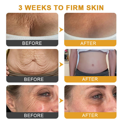 BeeVenom™ 😍Crema Botox Arrugas Multi-Proposito