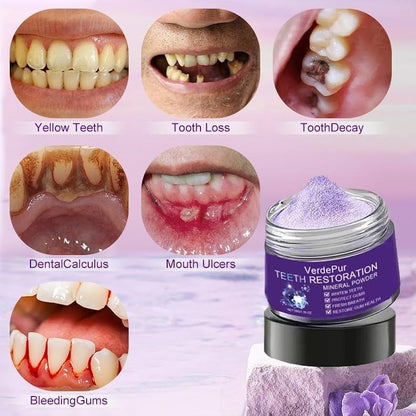 ENVÍO GRATIS🔥𝙈𝙞𝙣𝙚𝙧𝙖𝙡 𝙍𝙚𝙨𝙩𝙖𝙪𝙧𝙖𝙙𝙤𝙧 𝙎𝙤𝙣𝙧𝙞𝙨𝙖😍caries y manchas