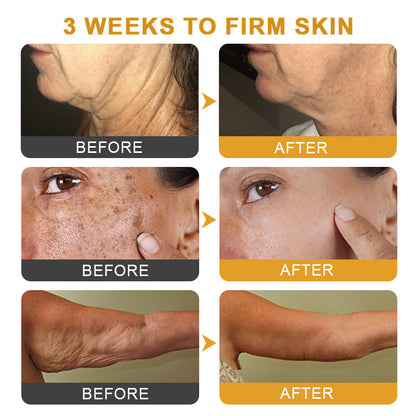 BeeVenom™ 😍Crema Botox Arrugas Multi-Proposito