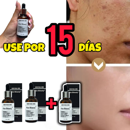 USE 15 DÍAS❗(COMPRE 2 & LLEVA 3)🎁Avanzado 500%⭐⭐⭐⭐⭐