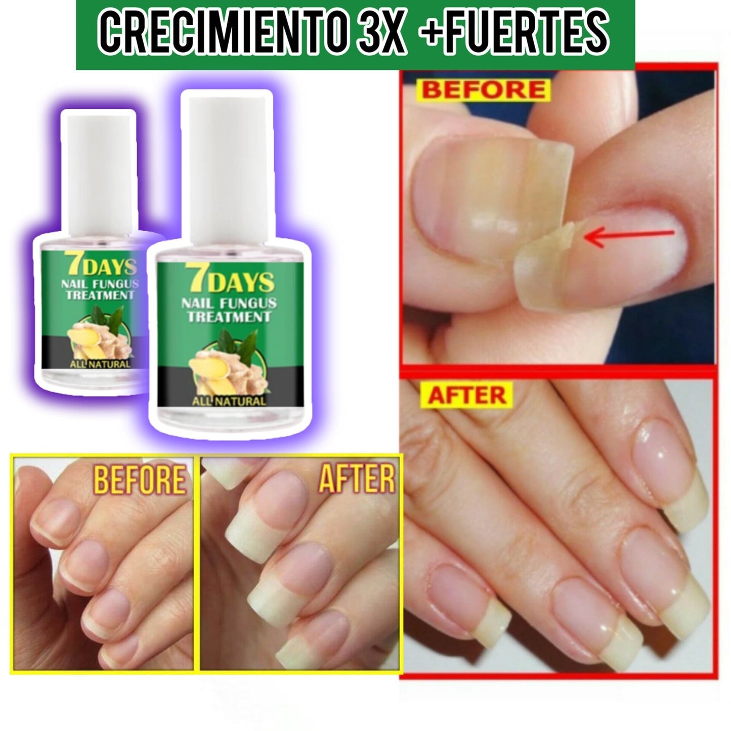 😍300% (COMPRA 1 & LLEVA 2)🎁Base Uñas 4 VECES Grandes