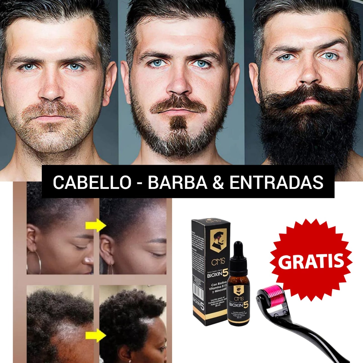 KIT TÓNICO + ROLLER🎁 - USO CABEZA, CEJAS & BARBA | HOMBRE & MUJER (Envío Gratis🔥)