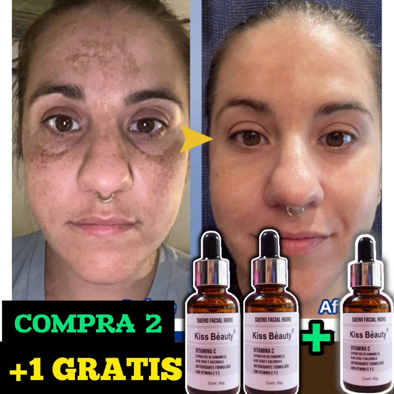 USE 15 DÍAS❗(COMPRE 2 & LLEVA 3)🎁Avanzado 500%⭐⭐⭐⭐⭐